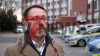 Verfolgungsjagd mit rund 20 Einsatzfahrzeugen - Polizeihubschrauber im Einsatz - Peugeot von Minderjährigen gestohlen - mehrere Unfälle während der Flucht - mutmaßliche Täter vorläufig festgenommen: 
